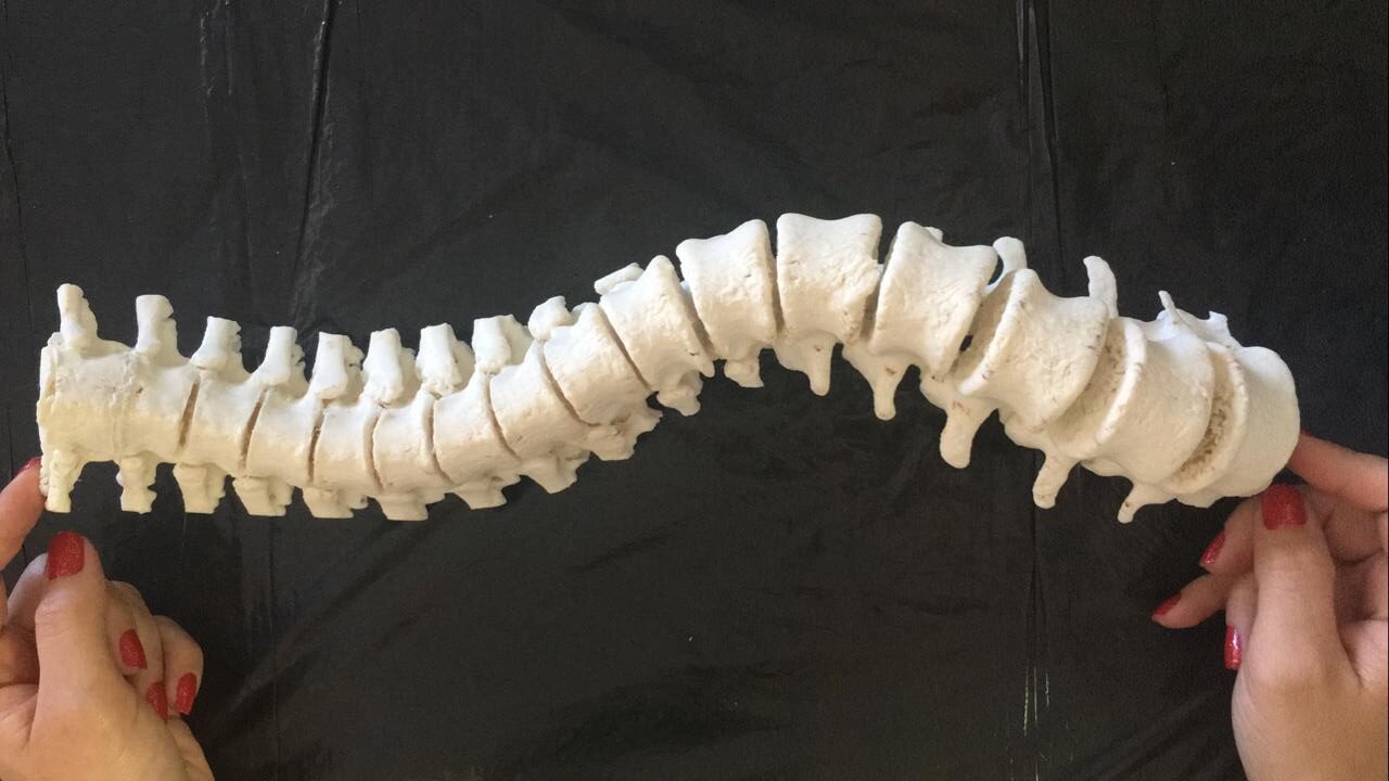 Leia mais sobre o artigo Laboratório goiano trabalha com  réplica 3D que revoluciona cirurgias de coluna